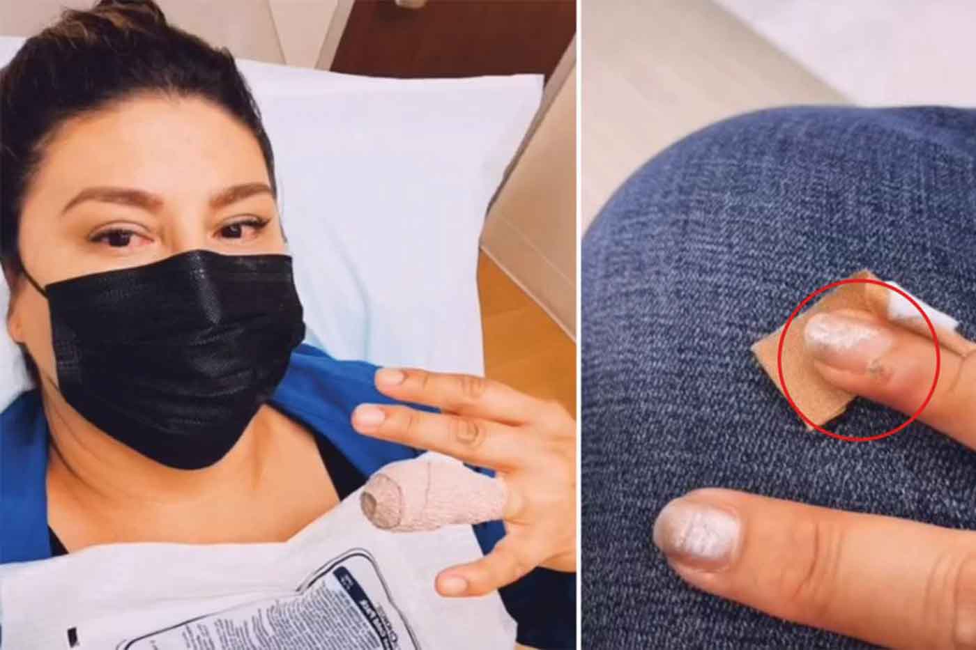 US-based woman diagnosed with skin cancer after aggressive manicure