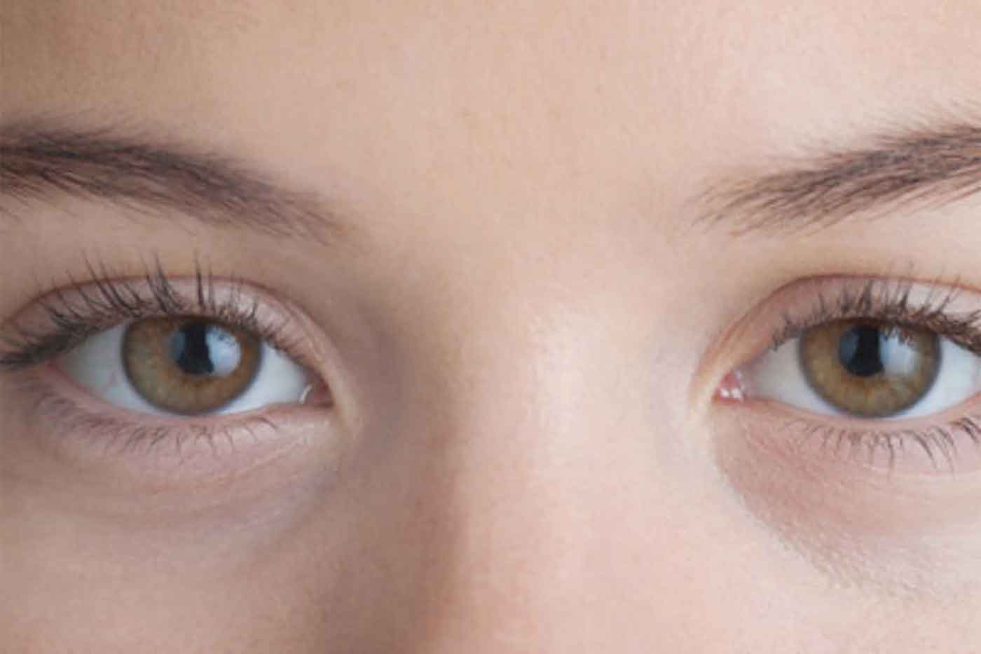 Dark Shadows Under the Eyes? - StyleSpeak