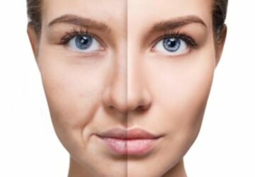 Collagen Supplements Improve Skin Health but Not Wrinkles